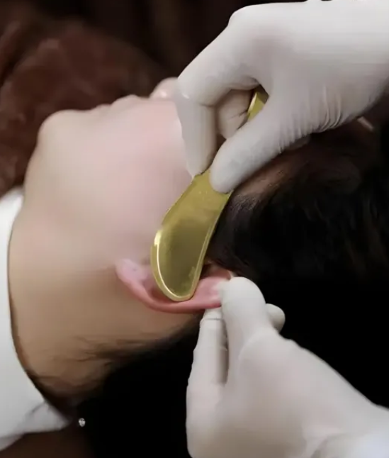 Traditional Chinese medicine specialty therapy – ear acupuncture scraping